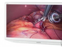 索尼推出全新4K 3D醫療顯示器