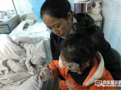 三星Note手機又爆炸 把女童炸成二級燒傷